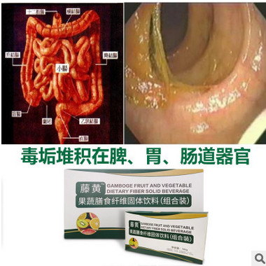 藤黄果果蔬复合固体饮料肠道排黏连垃圾酵素粉OEM代加工贴牌厂家图2