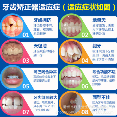 旺生堂儿童牙齿矫正器龅牙深覆盖地包天反颌牙齿不齐K1硅胶牙套图2