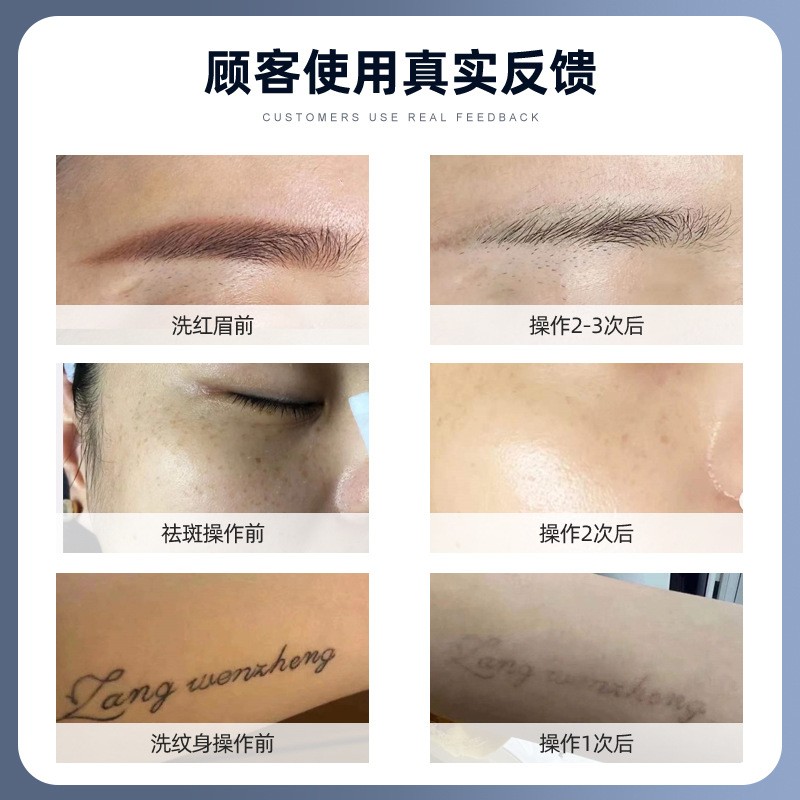 黑脸娃娃激光洗眉机红瞄皮秒笔小气泡眼部超声波美白新品美容仪器图4